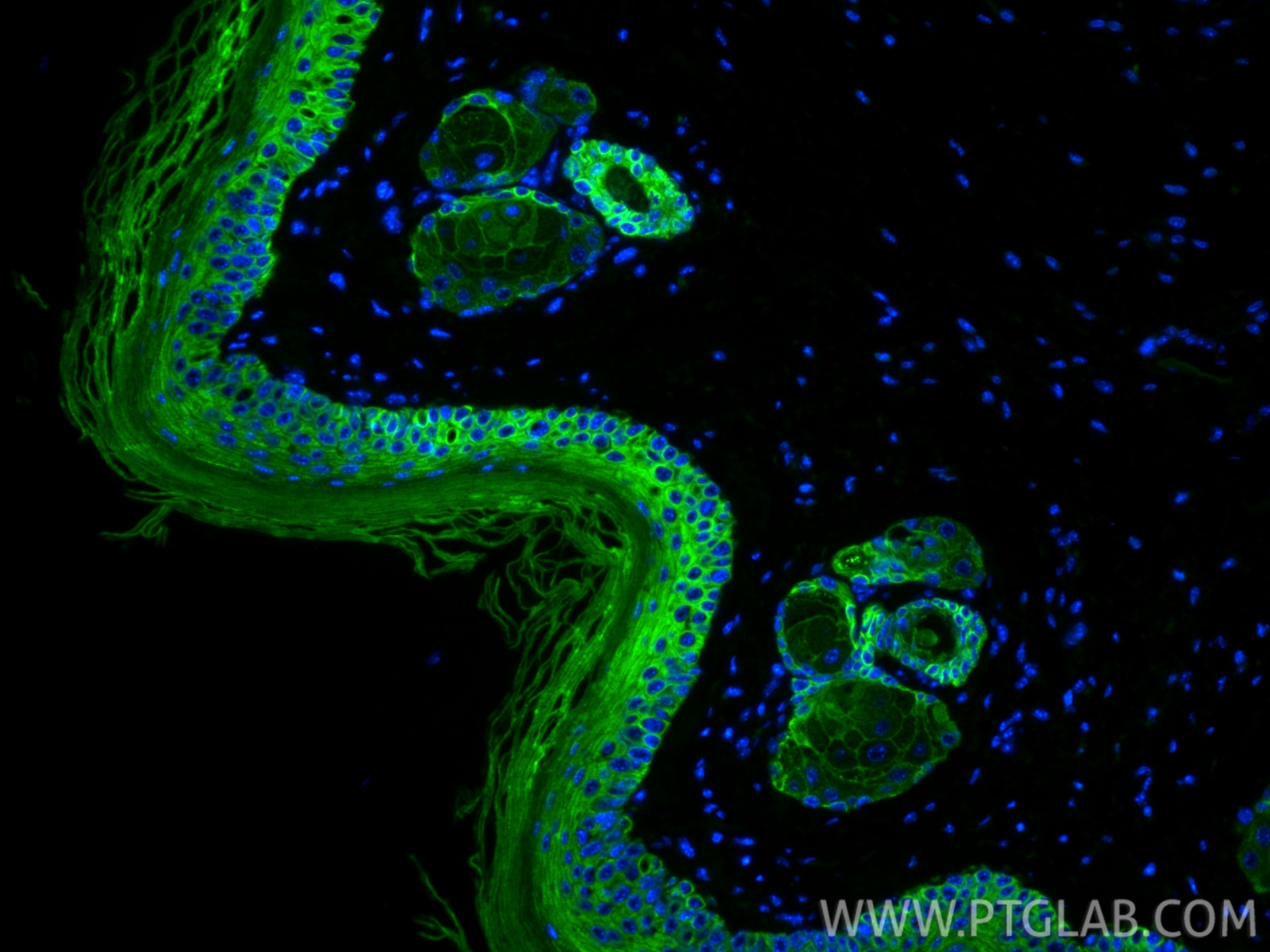 Immunofluorescence (IF) / fluorescent staining of mouse skin tissue using Cytokeratin 15 Monoclonal antibody (60247-1-Ig)