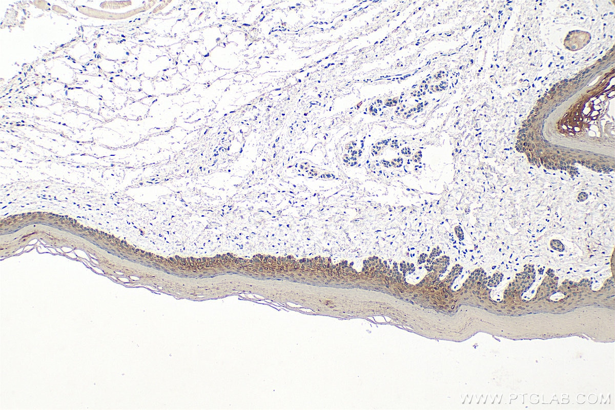 Immunohistochemical analysis of paraffin-embedded mouse skin tissue slide using 60247-1-Ig (Cytokeratin 15 antibody) at dilution of 1:4000 (under 10x lens). Heat mediated antigen retrieval with Tris-EDTA buffer (pH 9.0). Immunohistochemistry (IHC) staining of mouse skin tissue using Cytokeratin 15 Monoclonal antibody (60247-1-Ig)