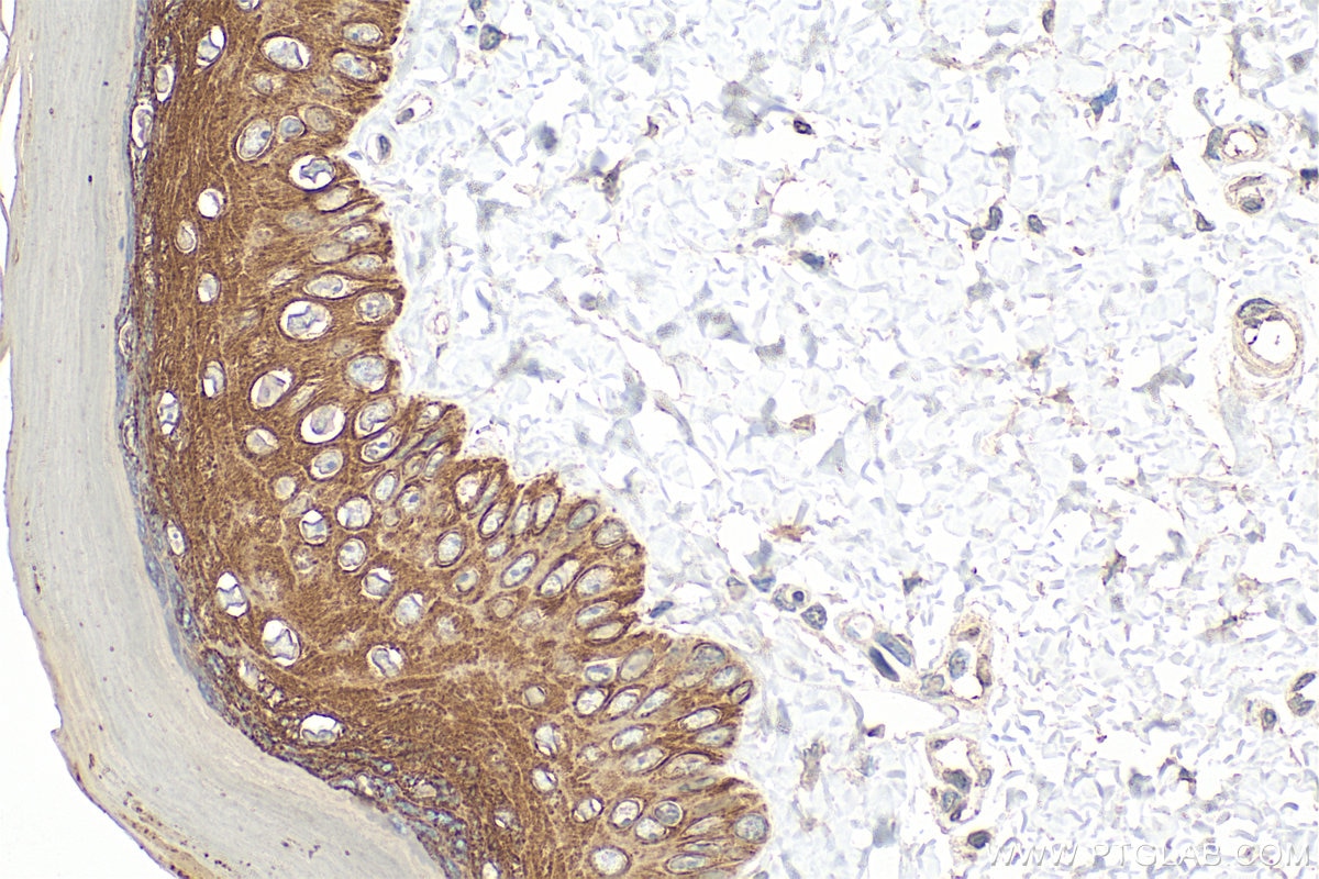 Immunohistochemical analysis of paraffin-embedded rat skin tissue slide using 60247-1-Ig (Cytokeratin 15 antibody) at dilution of 1:4000 (under 40x lens). Heat mediated antigen retrieval with Tris-EDTA buffer (pH 9.0). Immunohistochemistry (IHC) staining of rat skin tissue using Cytokeratin 15 Monoclonal antibody (60247-1-Ig)