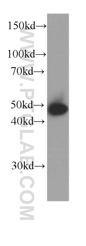 Western Blot (WB) analysis of A431 cells using Cytokeratin 15 Monoclonal antibody (60247-1-Ig)