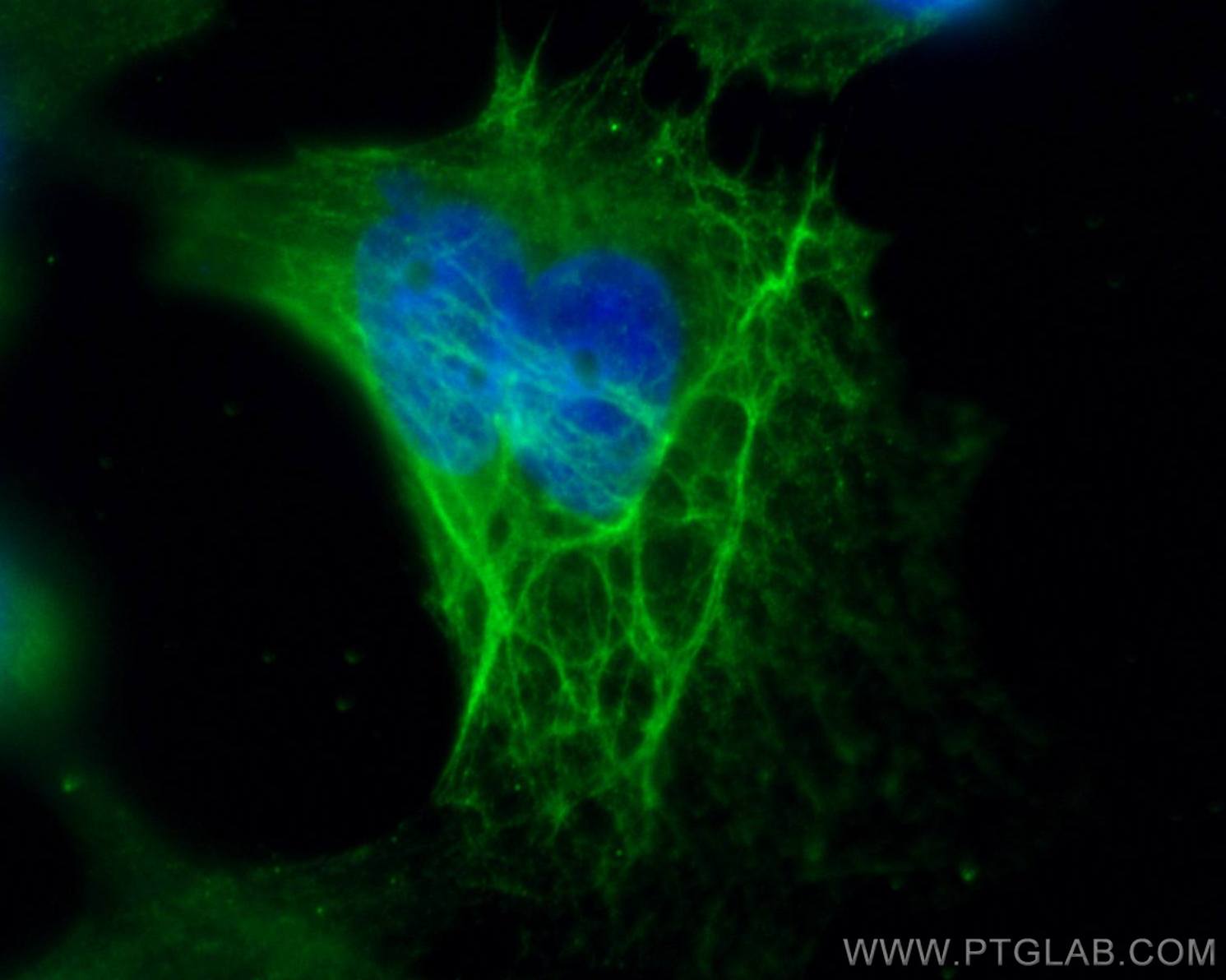 Cytokeratin 16