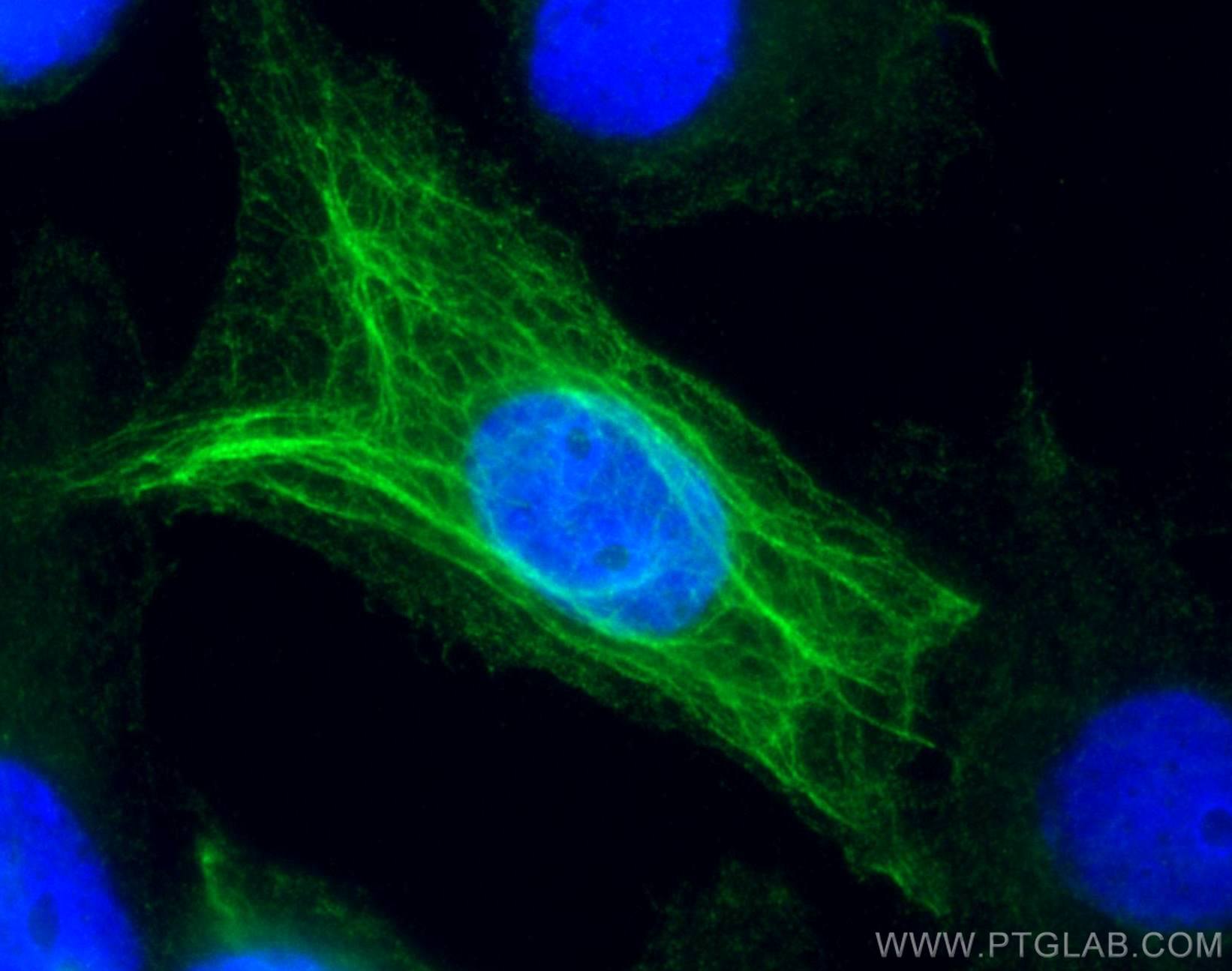 Immunofluorescence (IF) / fluorescent staining of A431 cells using Cytokeratin 16 Polyclonal antibody (17265-1-AP)