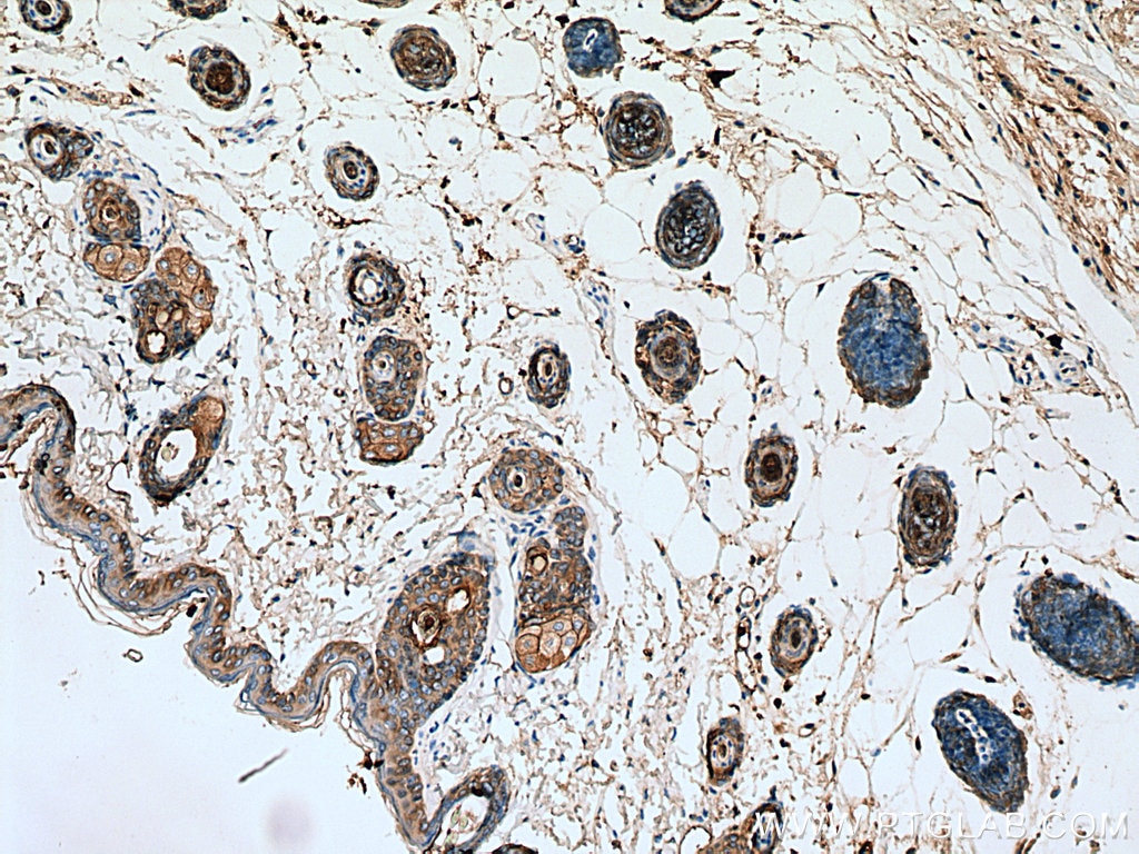 Immunohistochemistry (IHC) staining of mouse skin tissue using Cytokeratin 16 Polyclonal antibody (17265-1-AP)