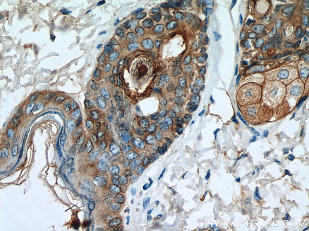 Immunohistochemistry (IHC) staining of mouse skin tissue using Cytokeratin 16 Polyclonal antibody (17265-1-AP)