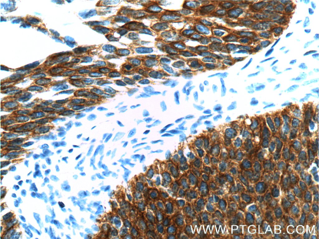 Cytokeratin 16 Polyclonal antibody