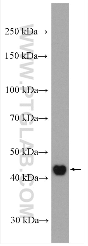 Western Blot (WB) analysis of HeLa cells using Cytokeratin 16 Polyclonal antibody (17265-1-AP)