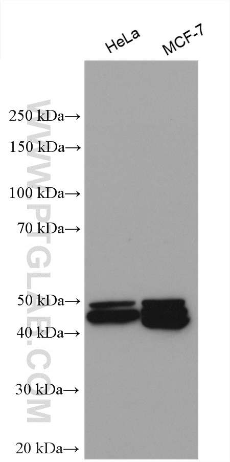 Western Blot (WB) analysis of various lysates using Cytokeratin 16 Polyclonal antibody (17265-1-AP)