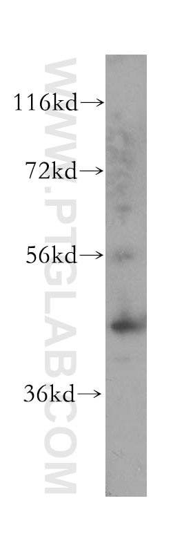 Western Blot (WB) analysis of A375 cells using Cytokeratin 16 Polyclonal antibody (17265-1-AP)