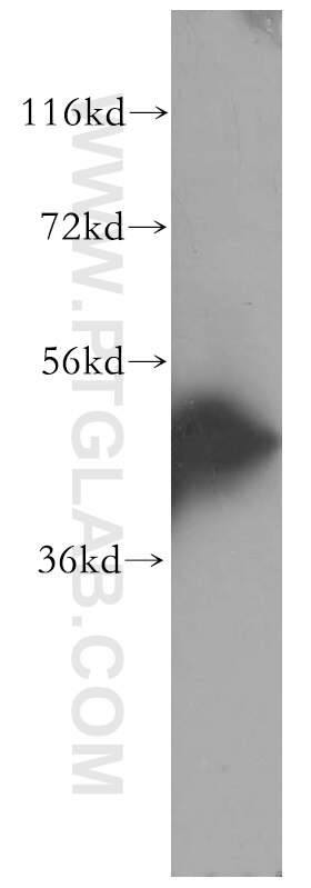 WB analysis of MCF-7 using 17265-1-AP