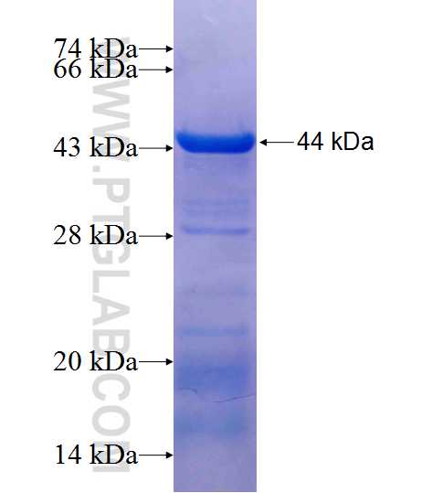 KRT16 fusion protein Ag11240 SDS-PAGE
