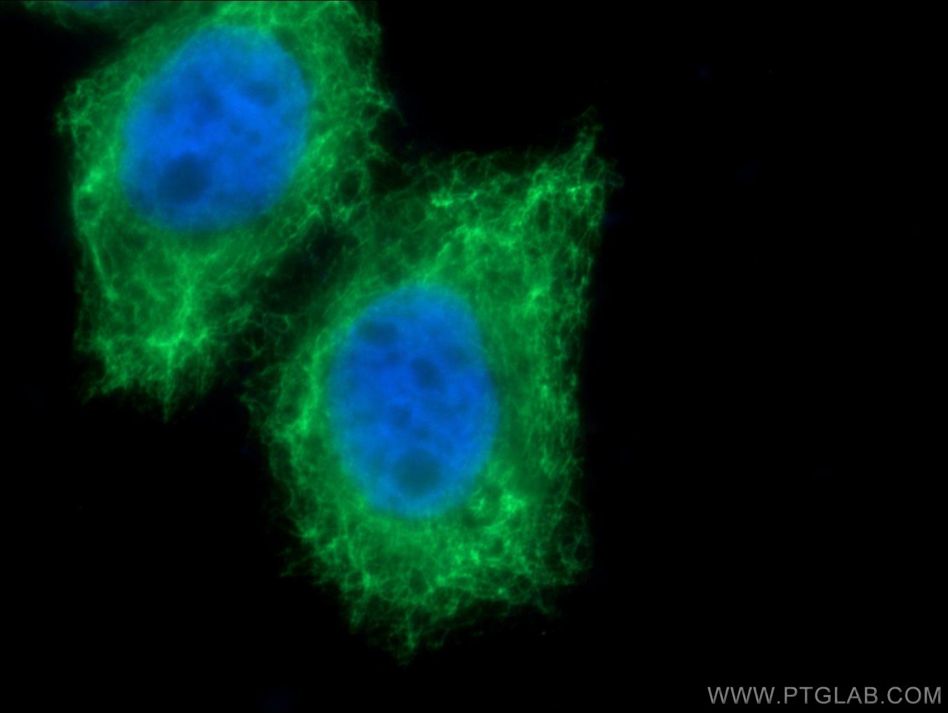 Immunofluorescence (IF) / fluorescent staining of HeLa cells using Cytokeratin 17 Polyclonal antibody (18502-1-AP)