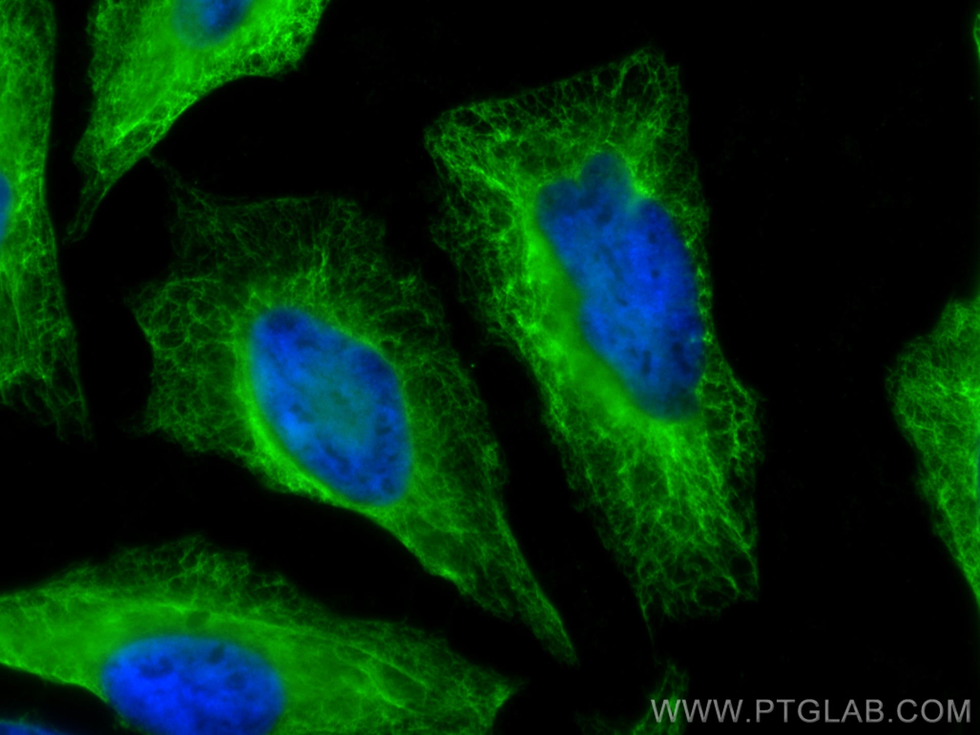 IF Staining of HeLa using 18502-1-AP