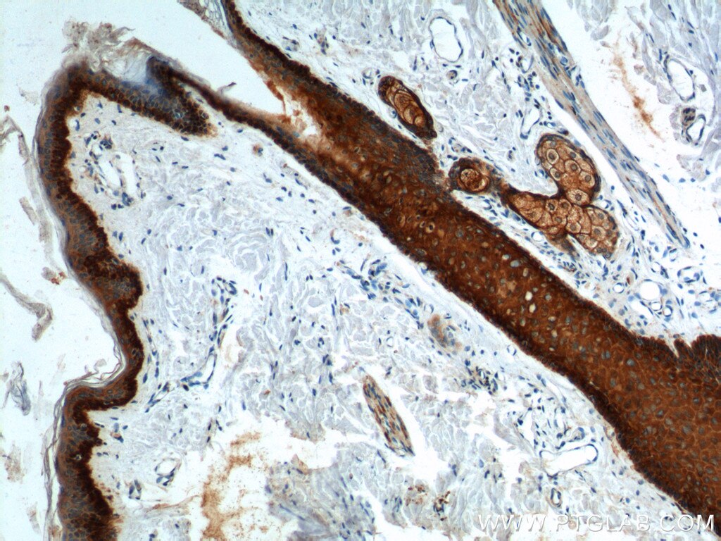 Immunohistochemistry (IHC) staining of human skin tissue using Cytokeratin 17 Polyclonal antibody (18502-1-AP)