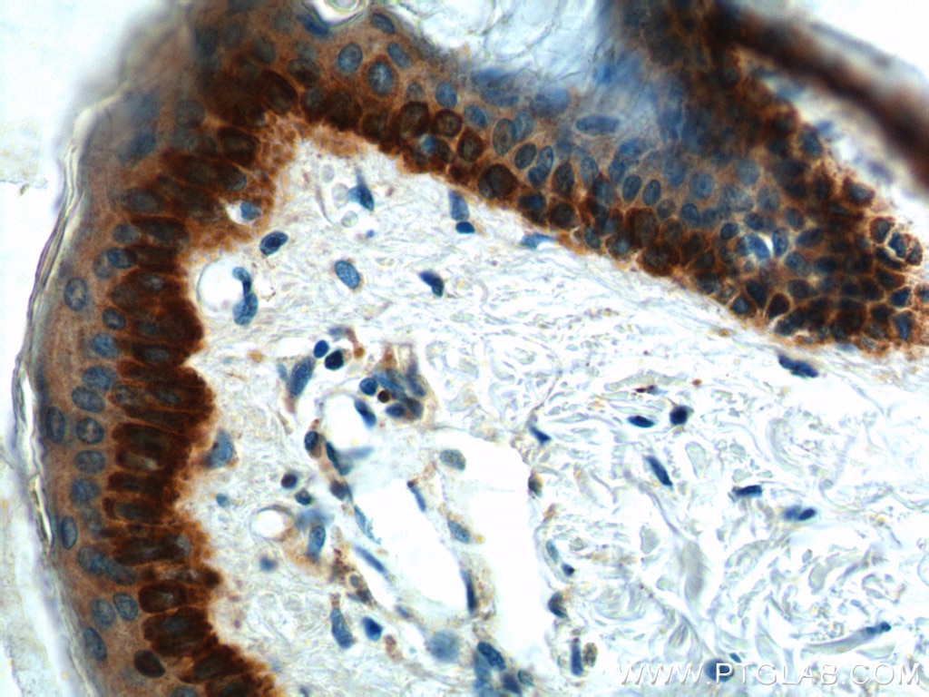 Immunohistochemistry (IHC) staining of human skin tissue using Cytokeratin 17 Polyclonal antibody (18502-1-AP)