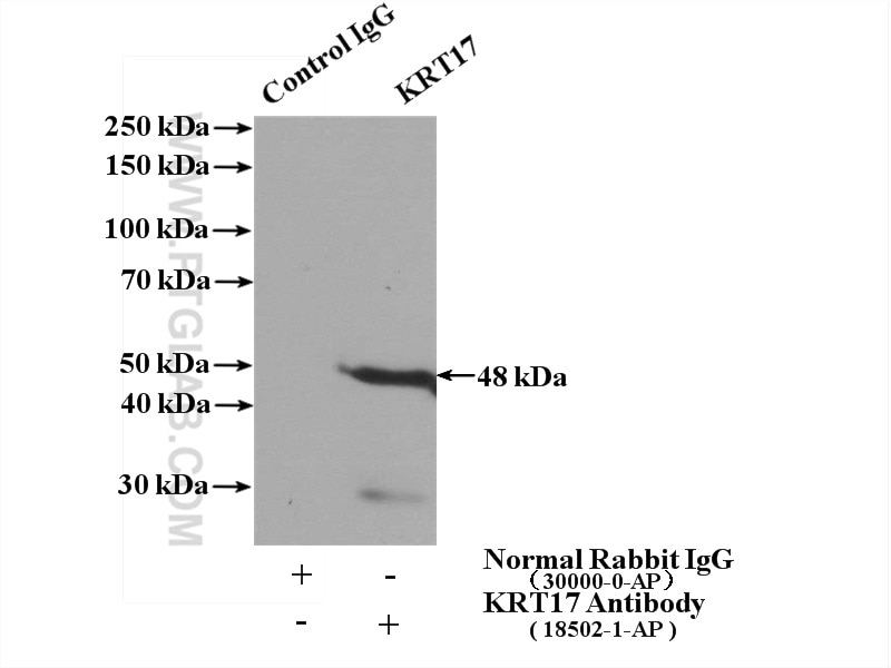 Immunoprecipitation (IP) experiment of HeLa cells using Cytokeratin 17 Polyclonal antibody (18502-1-AP)
