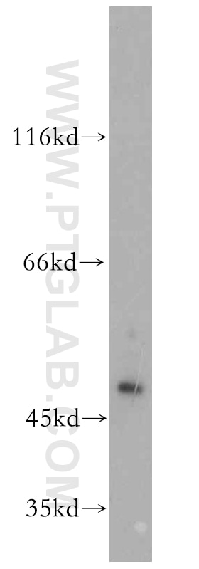 Western Blot (WB) analysis of A431 cells using Cytokeratin 17 Polyclonal antibody (18502-1-AP)