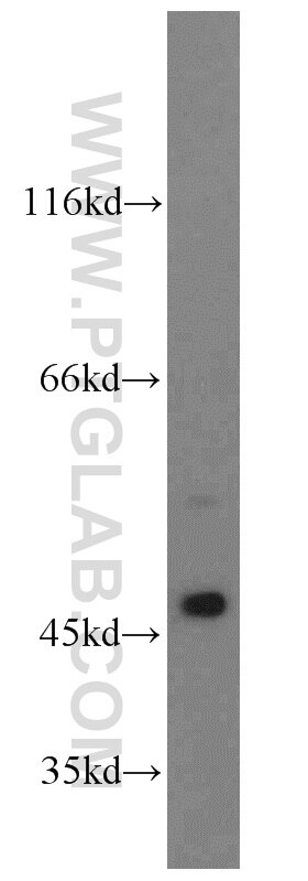 Western Blot (WB) analysis of HeLa cells using Cytokeratin 17 Polyclonal antibody (18502-1-AP)