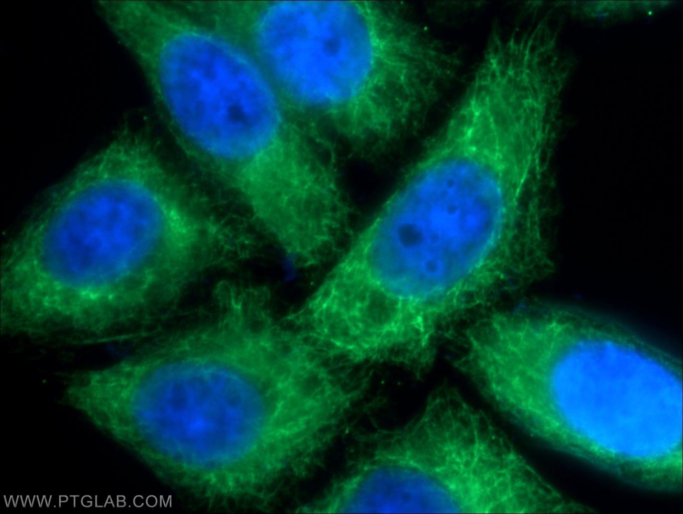 Immunofluorescence (IF) / fluorescent staining of HeLa cells using Cytokeratin 17 Polyclonal antibody (22230-1-AP)