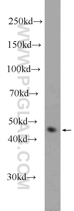 Western Blot (WB) analysis of MCF-7 cells using Cytokeratin 17 Polyclonal antibody (22230-1-AP)