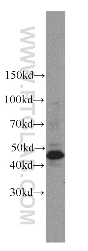Western Blot (WB) analysis of HeLa cells using Cytokeratin 17 Polyclonal antibody (22230-1-AP)