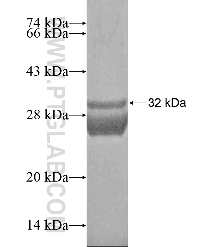 KRT17 fusion protein Ag17575 SDS-PAGE