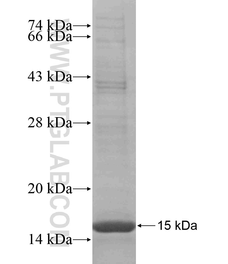KRT17 fusion protein Ag17657 SDS-PAGE