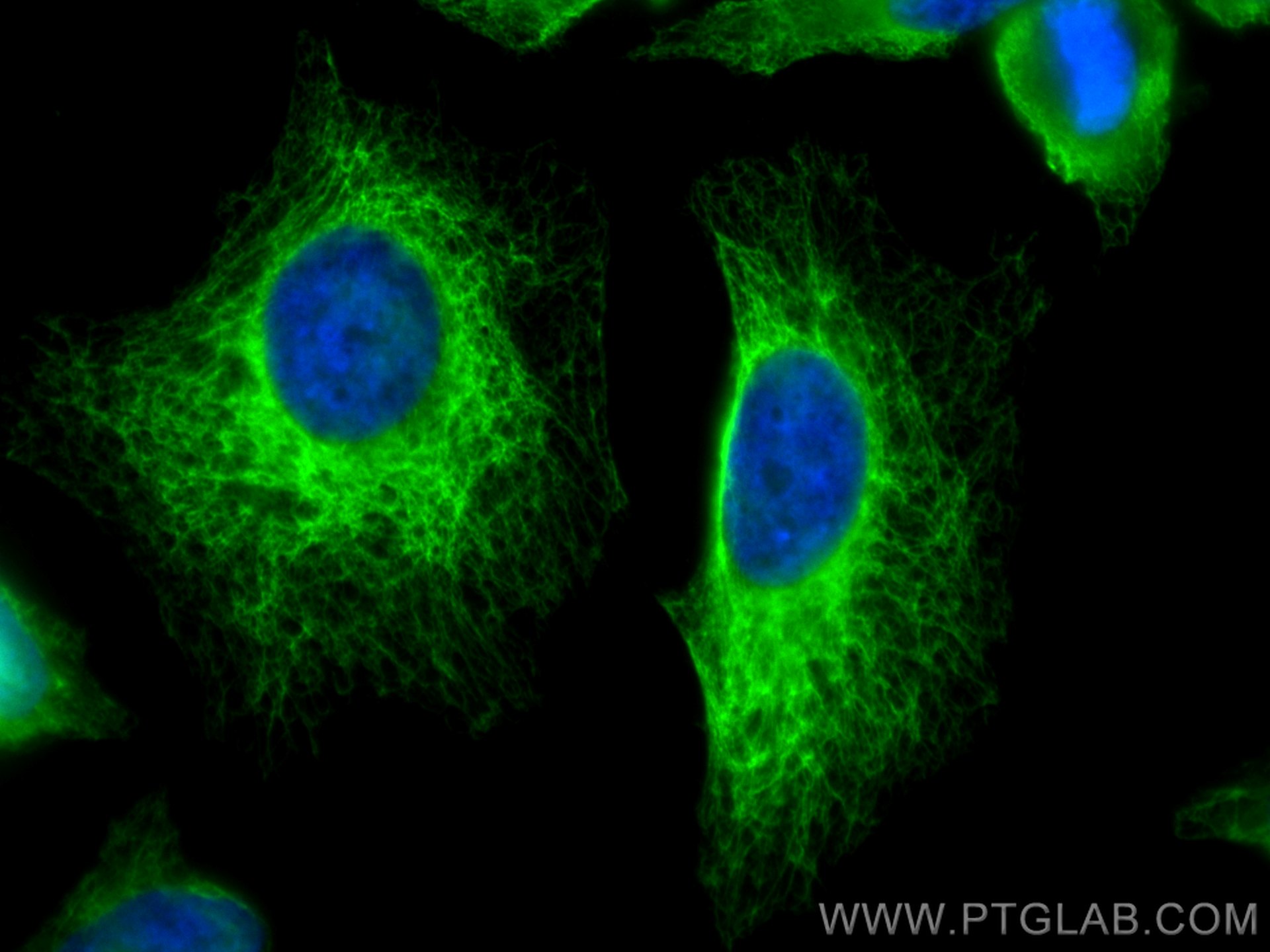Immunofluorescence (IF) / fluorescent staining of HeLa cells using Cytokeratin 17-Specific Polyclonal antibody (17516-1-AP)