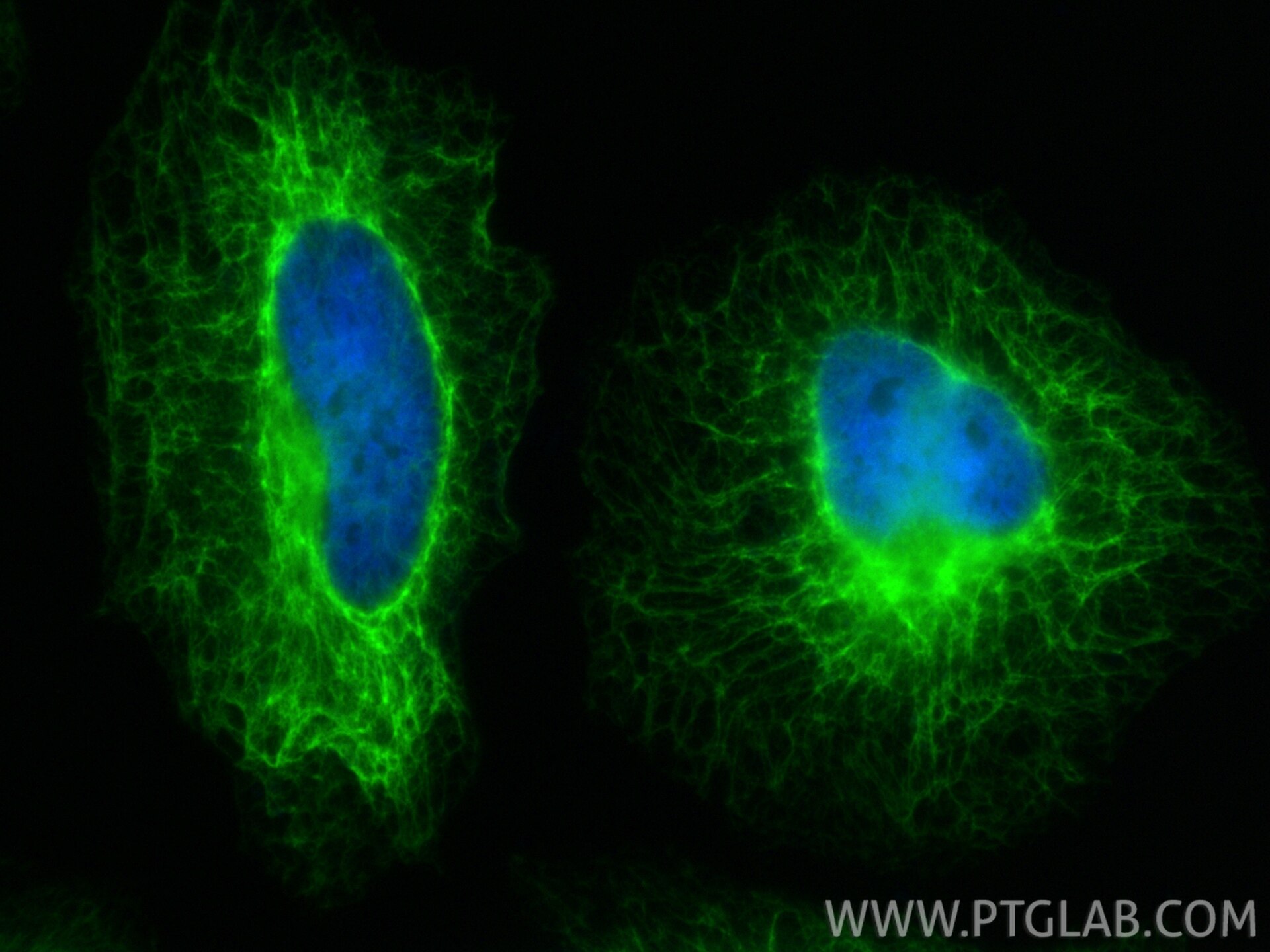 Immunofluorescence (IF) / fluorescent staining of HeLa cells using Cytokeratin 17-Specific Polyclonal antibody (17516-1-AP)