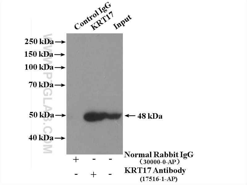 Immunoprecipitation (IP) experiment of A431 cells using Cytokeratin 17-Specific Polyclonal antibody (17516-1-AP)