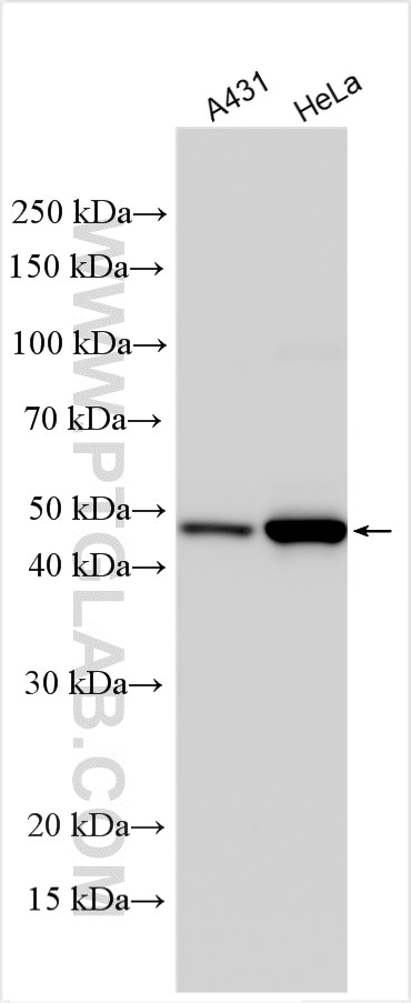 Western Blot (WB) analysis of various lysates using Cytokeratin 17-Specific Polyclonal antibody (17516-1-AP)