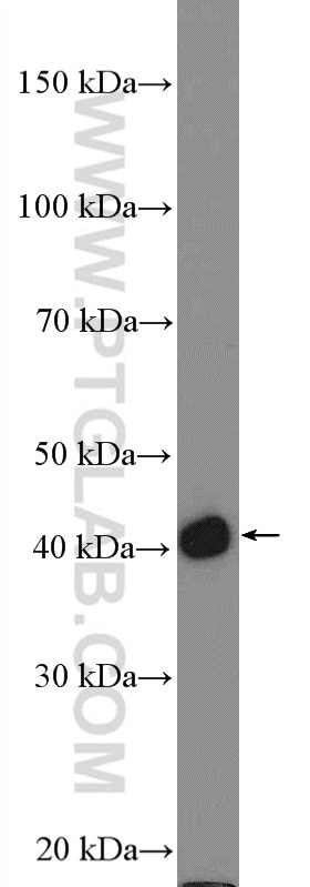 Western Blot (WB) analysis of mouse skin tissue using Cytokeratin 17-Specific Polyclonal antibody (17516-1-AP)