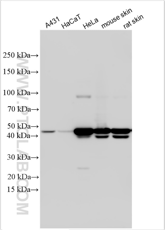 Western Blot (WB) analysis of various lysates using Cytokeratin 17-Specific Polyclonal antibody (17516-1-AP)