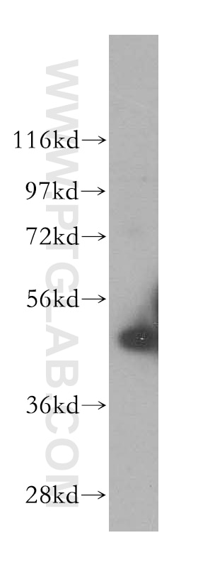Western Blot (WB) analysis of HeLa cells using Cytokeratin 17-Specific Polyclonal antibody (17516-1-AP)