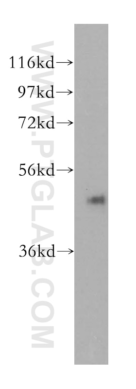 Western Blot (WB) analysis of HEK-293 cells using Cytokeratin 17-Specific Polyclonal antibody (17516-1-AP)