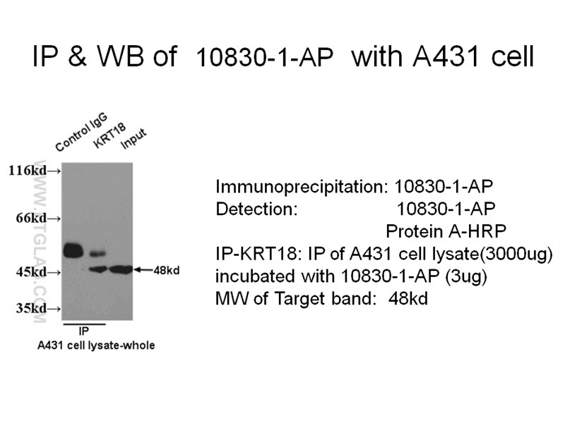 Cytokeratin 18