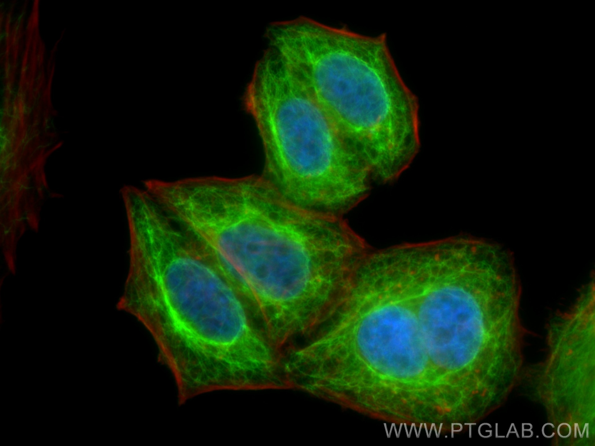 Immunofluorescence (IF) / fluorescent staining of HepG2 cells using Cytokeratin 18 Polyclonal antibody (10830-1-AP)