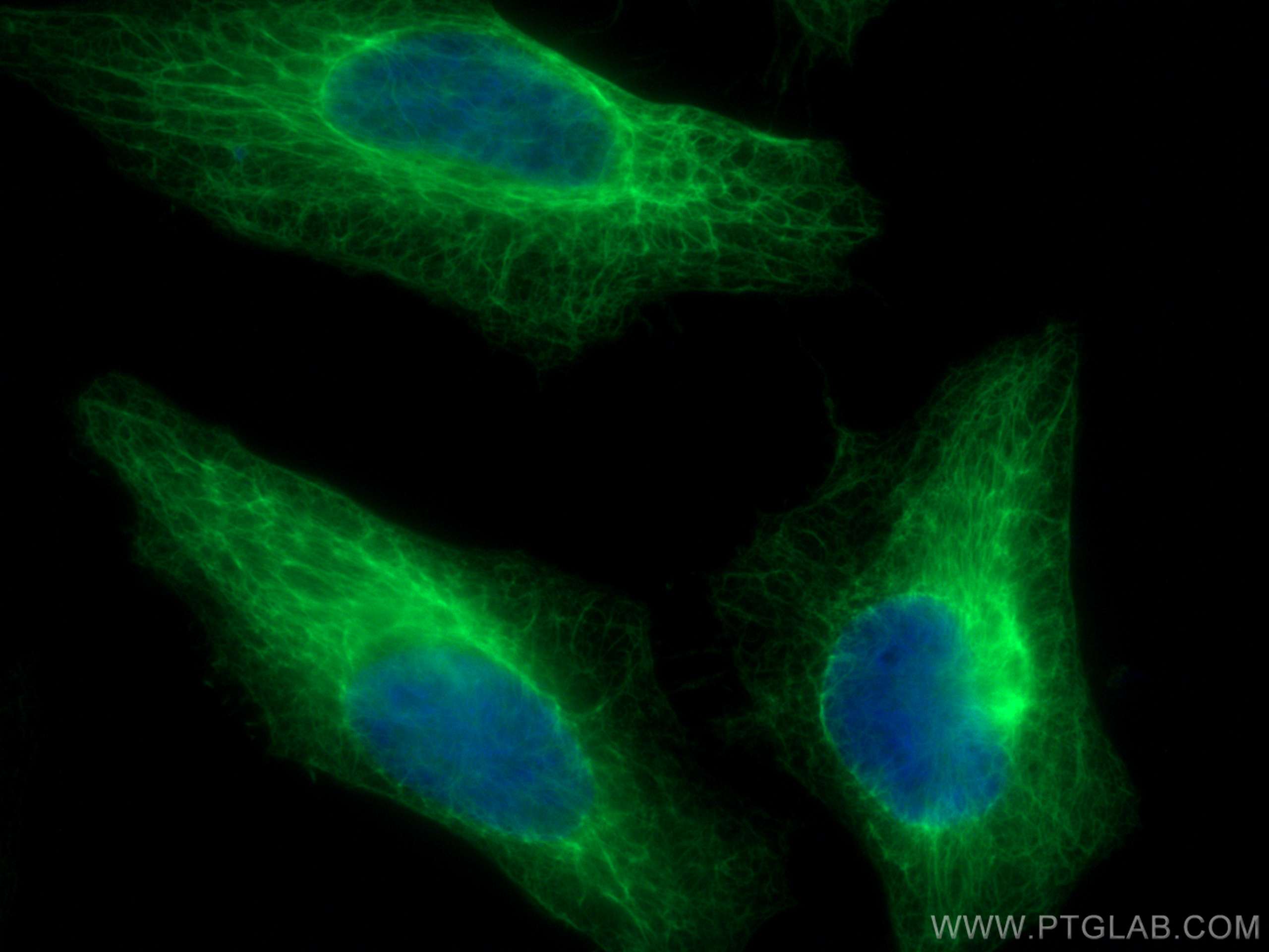 Immunofluorescence (IF) / fluorescent staining of HeLa cells using Cytokeratin 18 Polyclonal antibody (10830-1-AP)