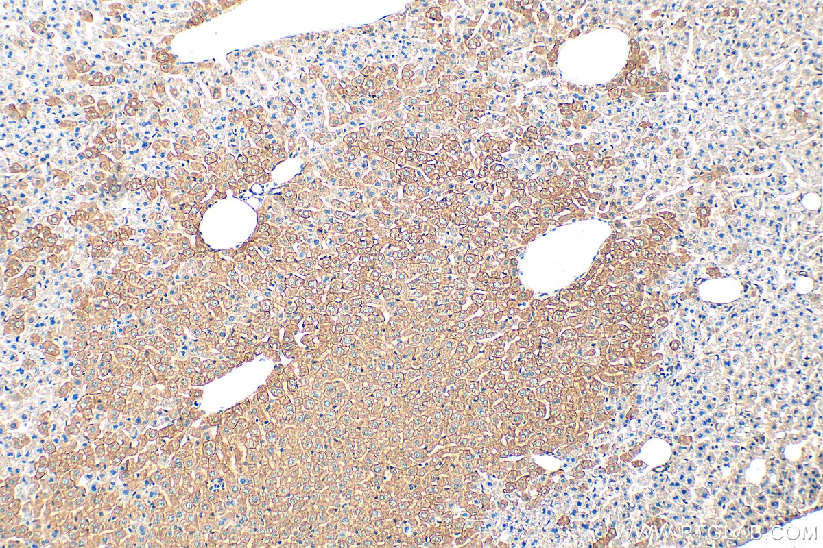 Immunohistochemistry (IHC) staining of mouse liver tissue using Cytokeratin 18 Polyclonal antibody (10830-1-AP)