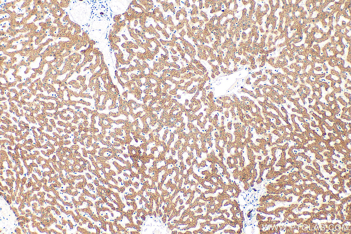 Immunohistochemistry (IHC) staining of human liver tissue using Cytokeratin 18 Polyclonal antibody (10830-1-AP)