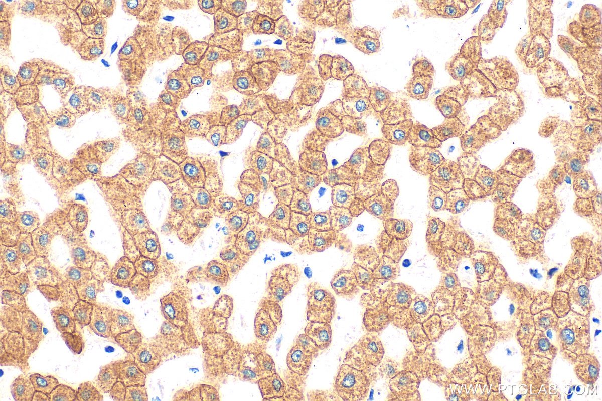 Immunohistochemistry (IHC) staining of human liver tissue using Cytokeratin 18 Polyclonal antibody (10830-1-AP)