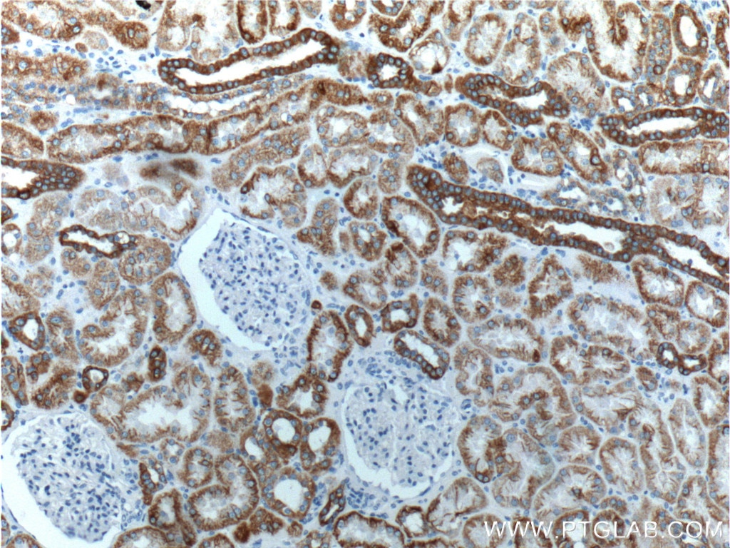 IHC staining of human kidney using 10830-1-AP