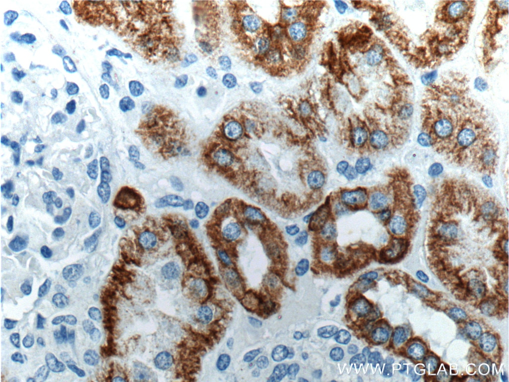 Immunohistochemistry (IHC) staining of human kidney tissue using Cytokeratin 18 Polyclonal antibody (10830-1-AP)