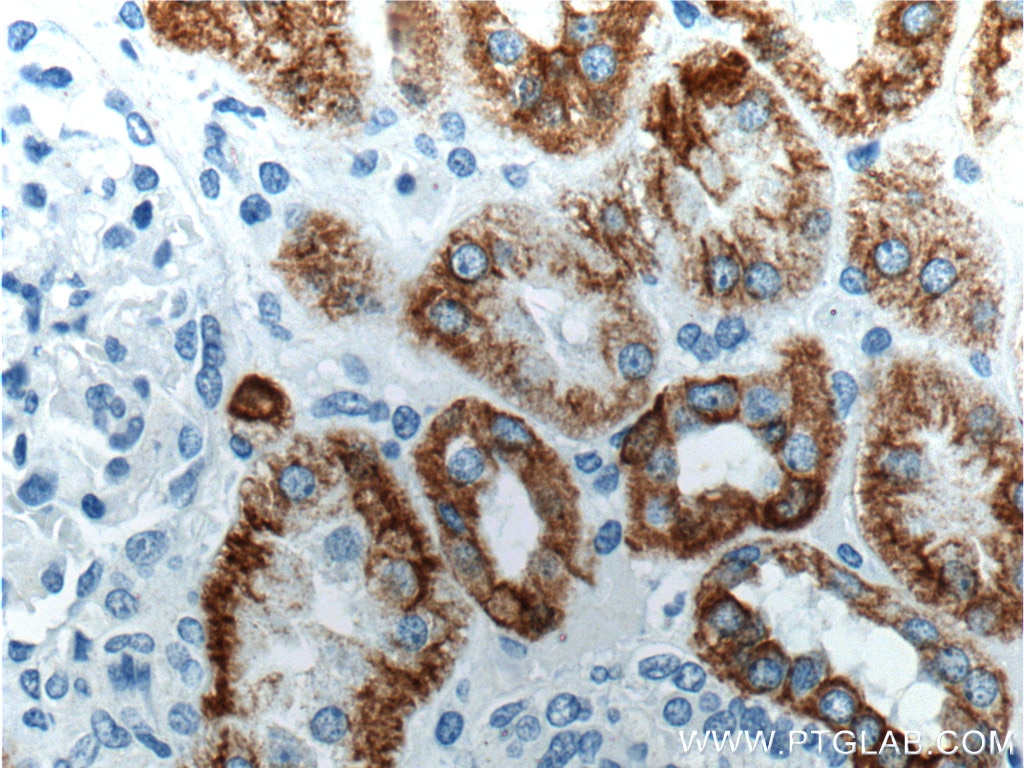 IHC staining of human kidney using 10830-1-AP