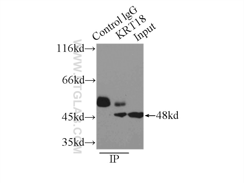 Immunoprecipitation (IP) experiment of A431 cells using Cytokeratin 18 Polyclonal antibody (10830-1-AP)
