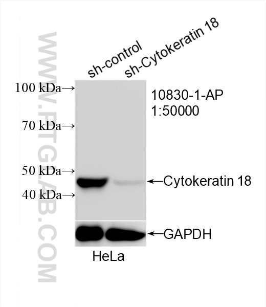 Western Blot (WB) analysis of HeLa cells using Cytokeratin 18 Polyclonal antibody (10830-1-AP)