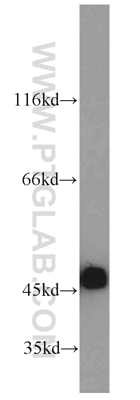 Western Blot (WB) analysis of A431 cells using Cytokeratin 18 Polyclonal antibody (10830-1-AP)