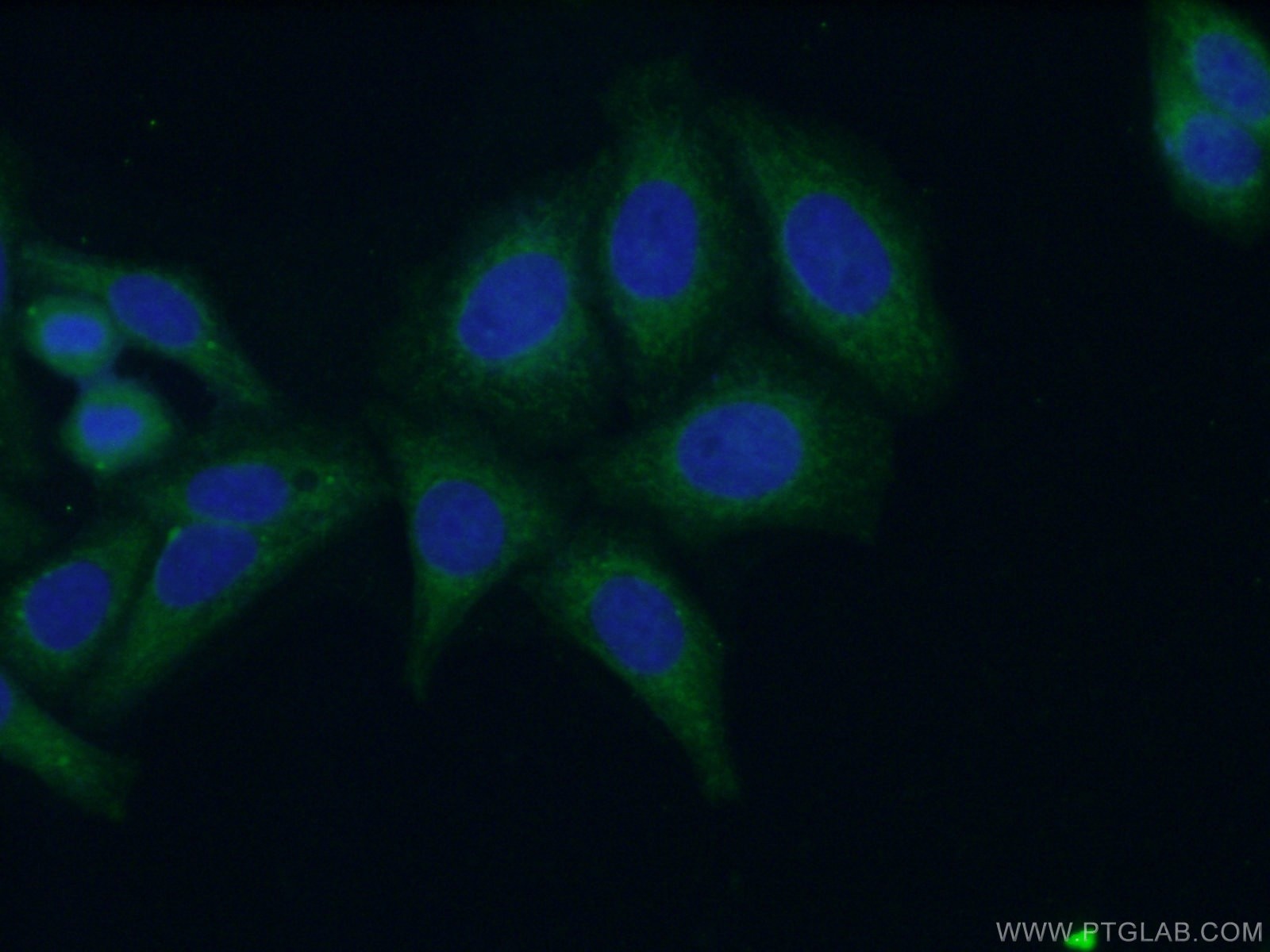 Immunofluorescence (IF) / fluorescent staining of HepG2 cells using Cytokeratin 18 Polyclonal antibody (18708-1-AP)