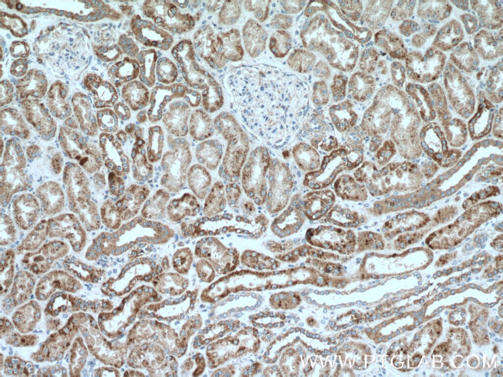 Immunohistochemistry (IHC) staining of human kidney tissue using Cytokeratin 18 Polyclonal antibody (18708-1-AP)