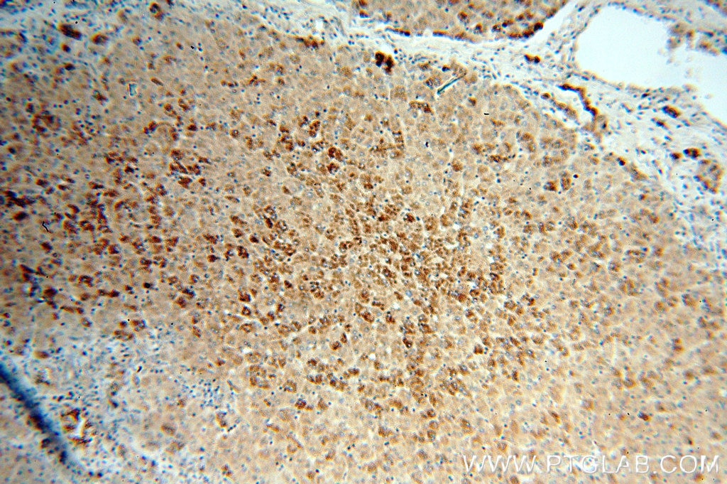 Immunohistochemistry (IHC) staining of human liver tissue using Cytokeratin 18 Polyclonal antibody (18708-1-AP)