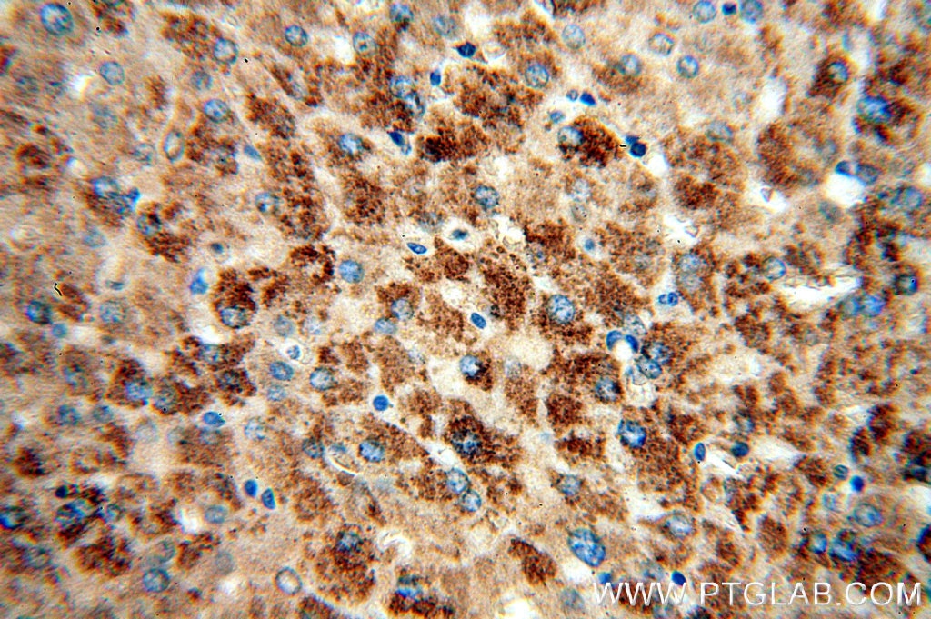 Immunohistochemistry (IHC) staining of human liver tissue using Cytokeratin 18 Polyclonal antibody (18708-1-AP)
